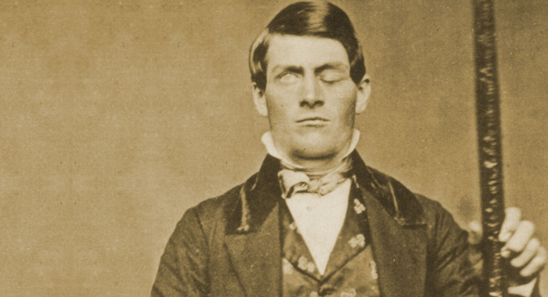 Phineas-Gage-Brain-Science